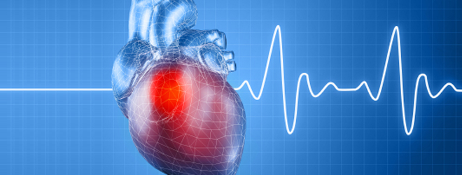 Sindrome660cardiologia.png